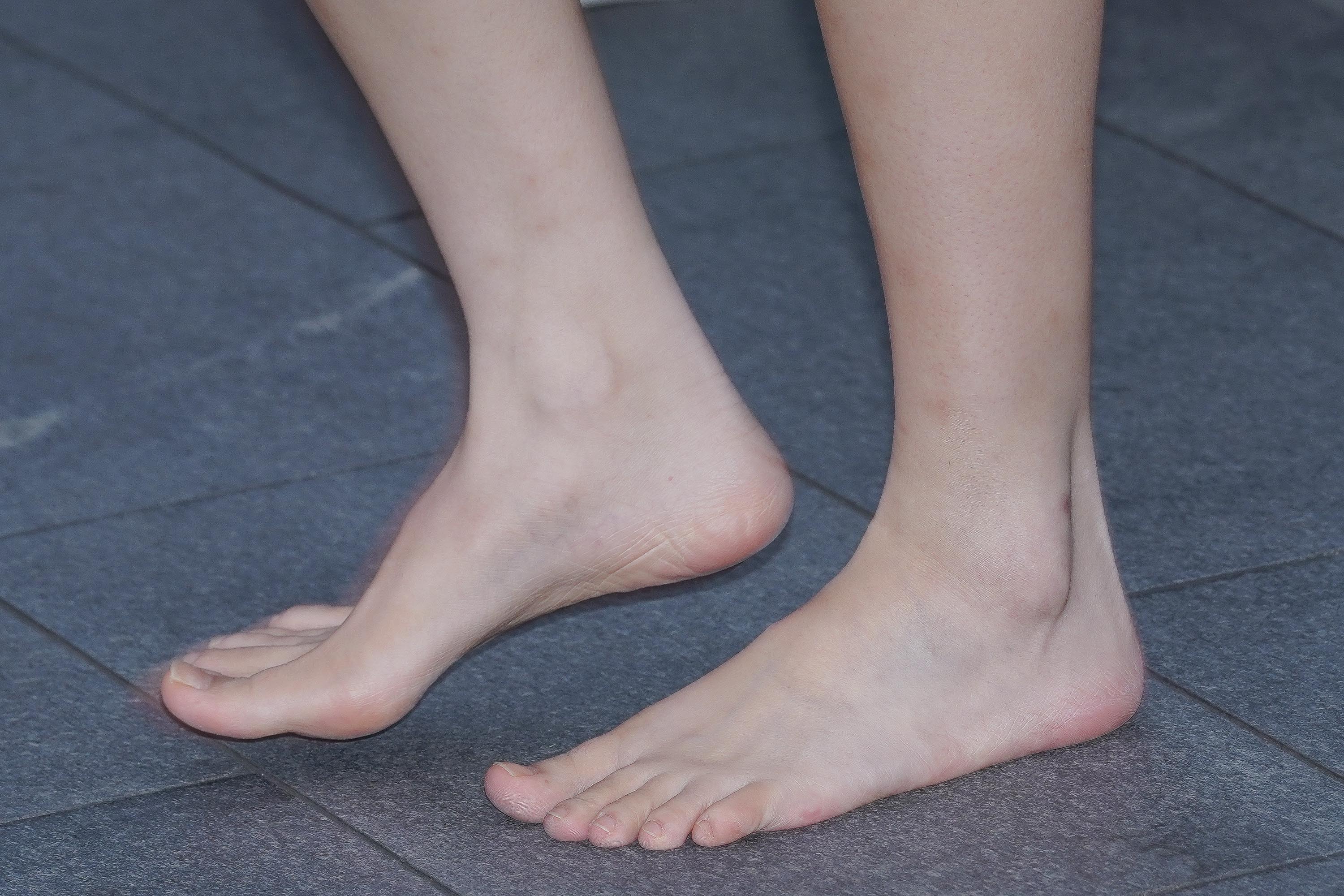 【2023年9月】赤脚女孩_好想背她-共18P